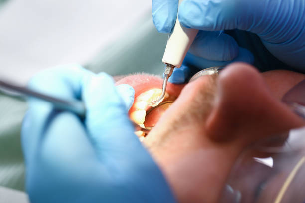 Best Emergency Dental Care for Trauma or Injury in Winfield, IA