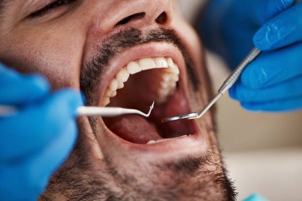 Best After-Hours Emergency Dentist in Winfield, IA