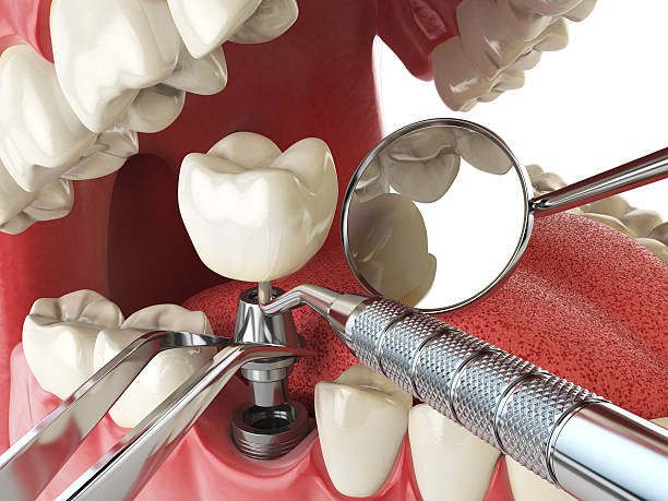 Best Emergency Treatment for Toothache in Winfield, IA